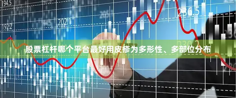 股票杠杆哪个平台最好用皮疹为多形性、多部位分布
